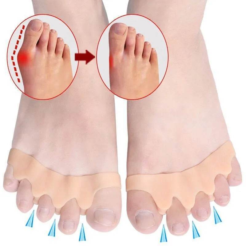 CozyStep™ Toe Separator: Say Goodbye to Hallux Valgus! - Image 8